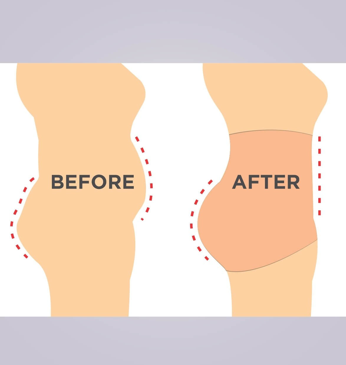 TRYLO TUMMY TUCKER-CORSET - Riza Garments Trading